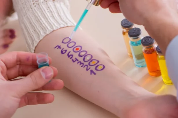 A Guide to Allergy Testing Methods