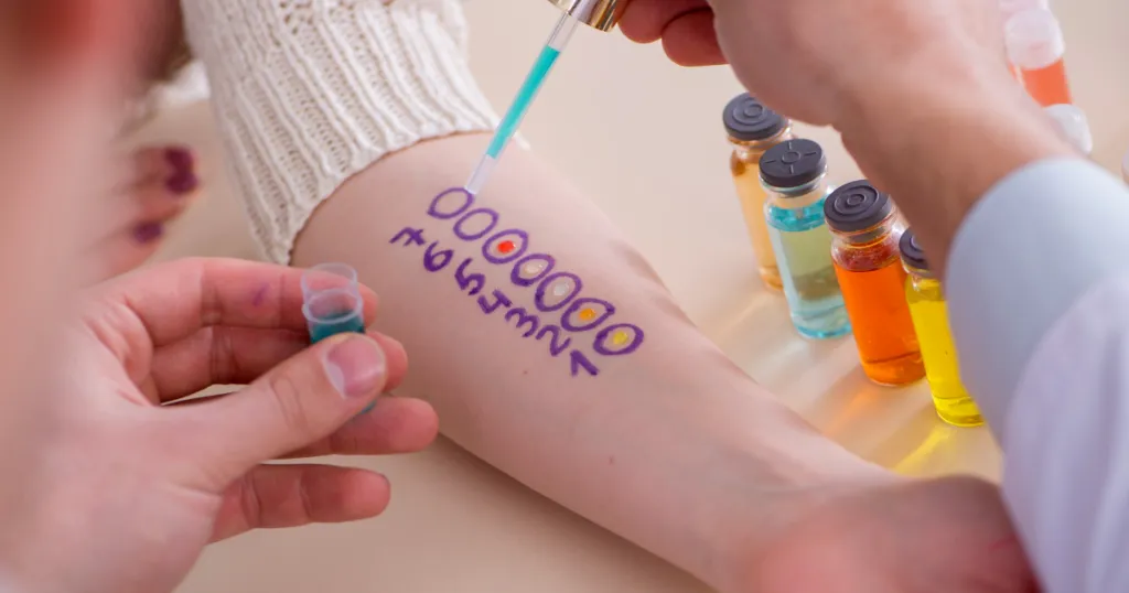 A Guide to Allergy Testing Methods