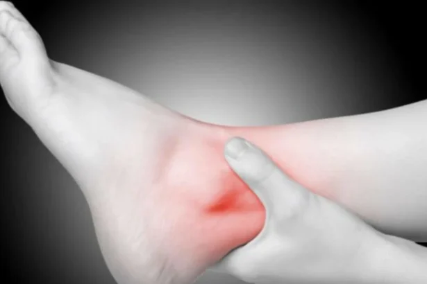 Rehabilitation Techniques for Athletes With Sprained Ankles
