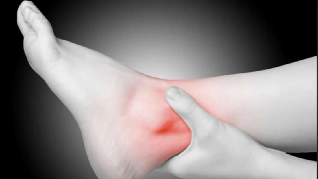 Rehabilitation Techniques for Athletes With Sprained Ankles