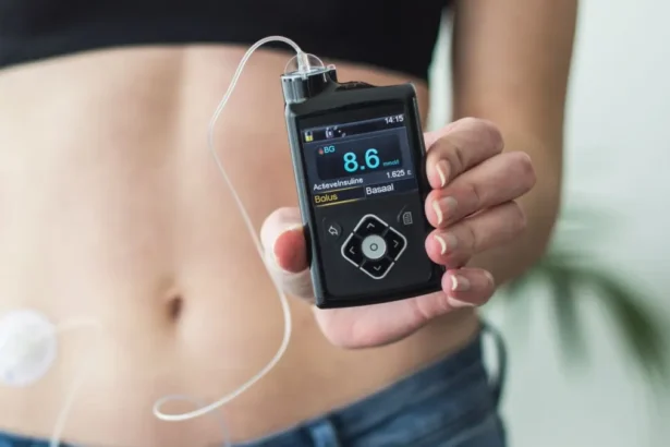 The Role of Diabetes Care in Weight Management