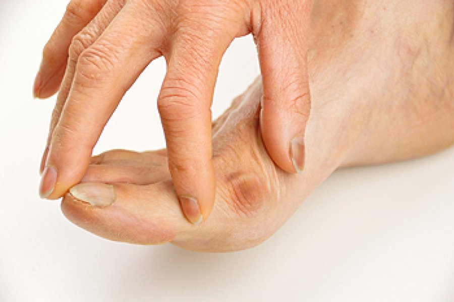 Understanding the Connection Between Bunions and Footwear Choices