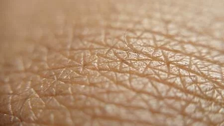 Understanding the Mohs Micrographic Surgery Procedure