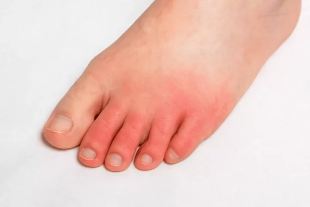What Are the Causes of Poor Circulation in My Legs?