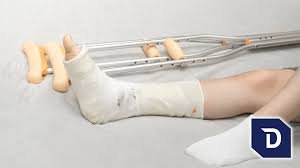 What To Expect on the Day of the Procedure for Ankle Replacement Surgery