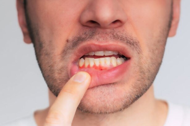 Gum Treatments That Can Help Reverse Early Gum Disease