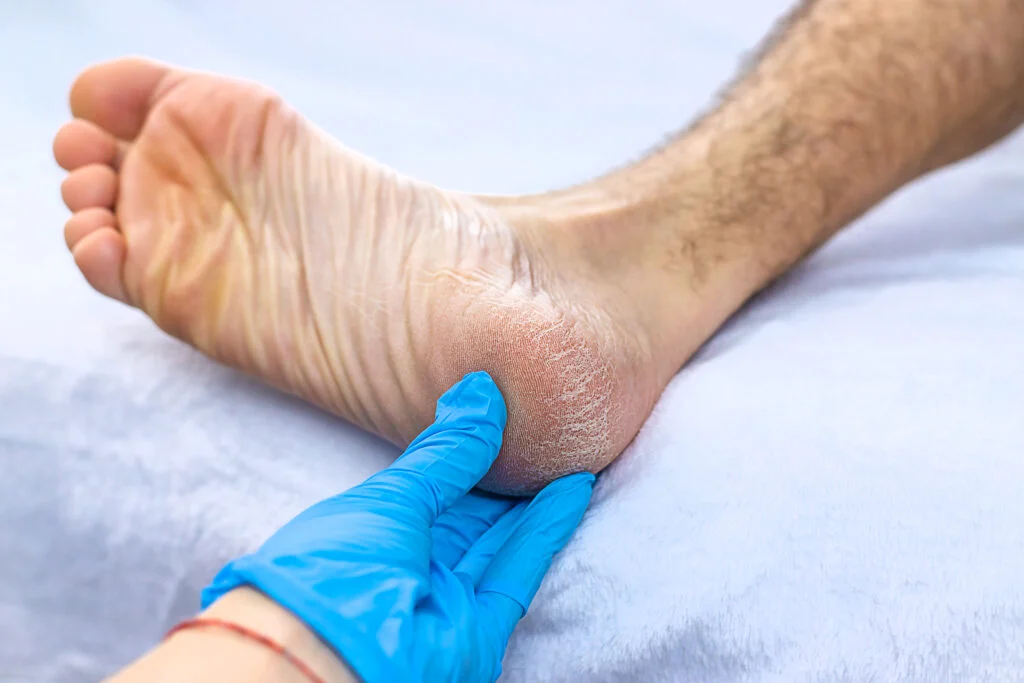Helpful Tips for Finding a Good Podiatrist in Your Area