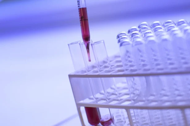 How To Prepare for Your Allergy Testing Appointment