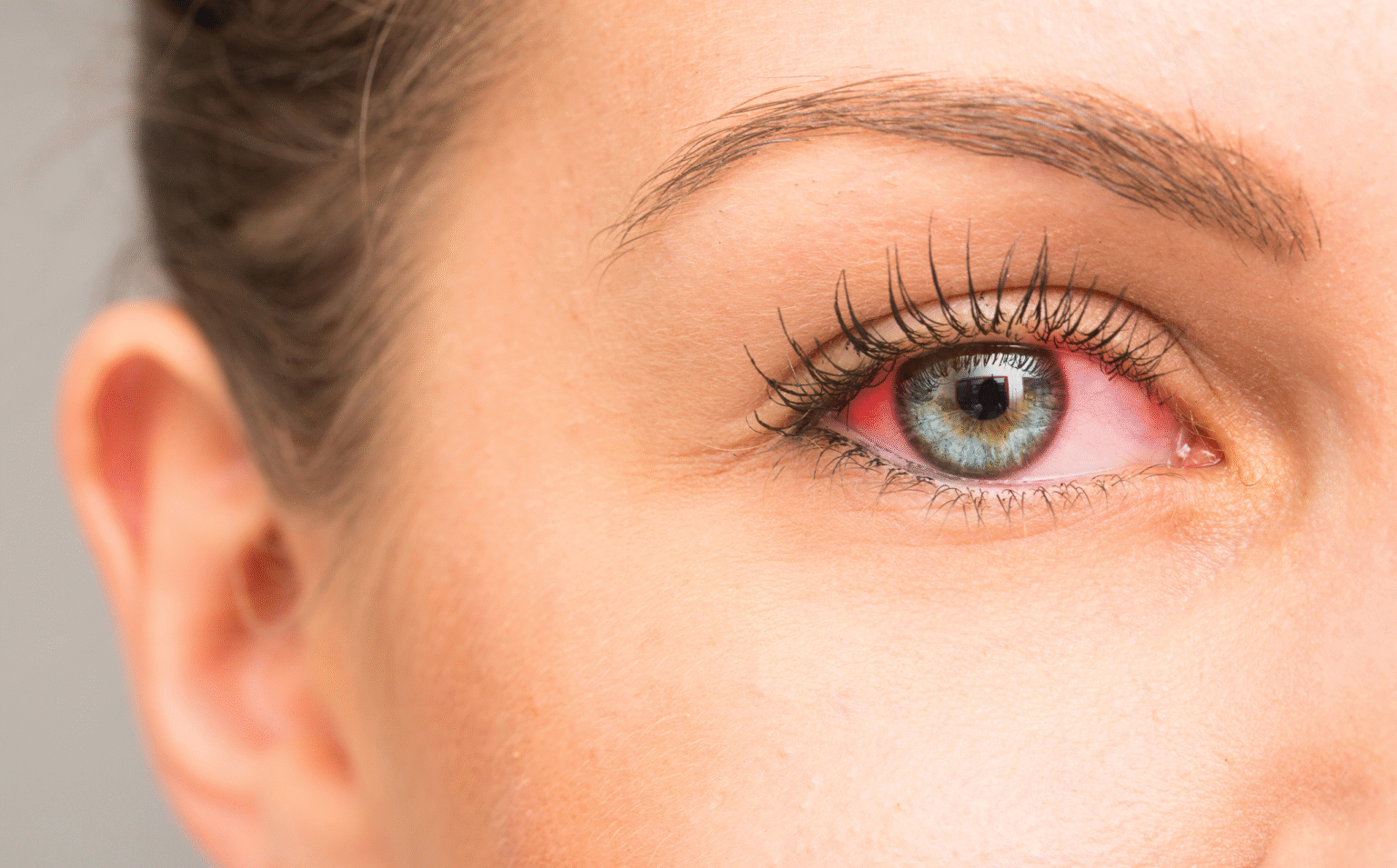Long-Term Effects of Untreated Dry Eyes