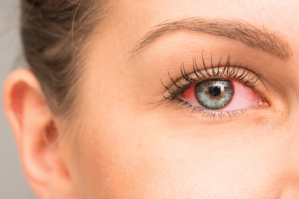 Long-Term Effects of Untreated Dry Eyes