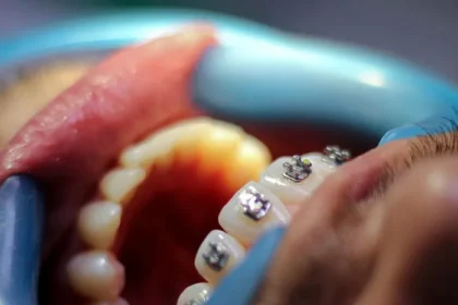 The Different Types of Orthodontic Treatments Available for All Ages