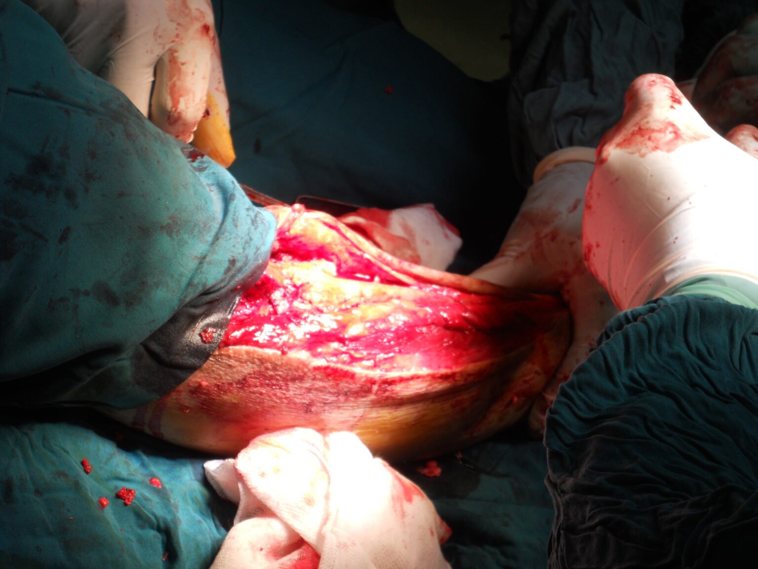 Procedures Performed by an Orthopedic Surgeon
