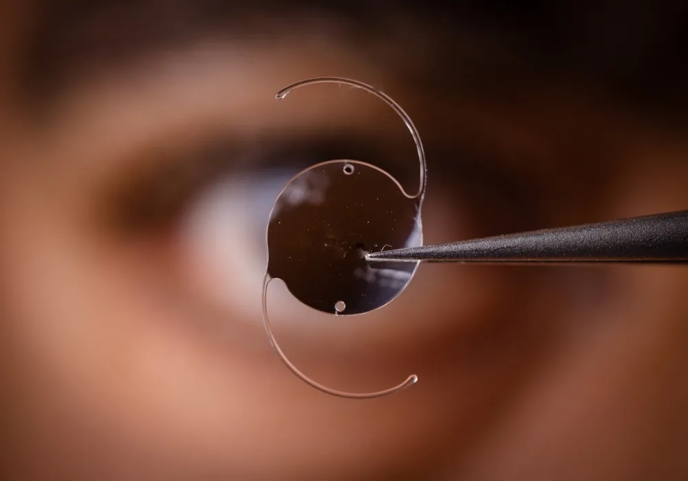 Understanding the Types of Cataract Surgery Available Today
