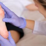 What Patients Should Know About Hip Arthroscopy Recovery