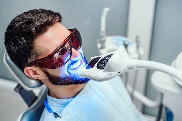 What To Know About Teeth Whitening Services