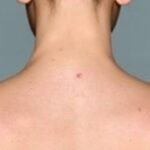 Skin Cancer Services in Modern Medicine