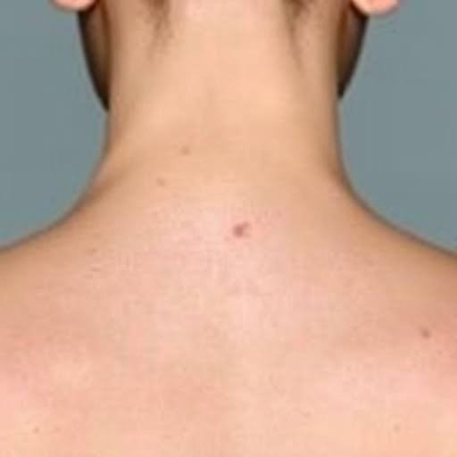 Skin Cancer Services in Modern Medicine