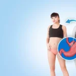 What To Expect Before and After Bariatric Surgery